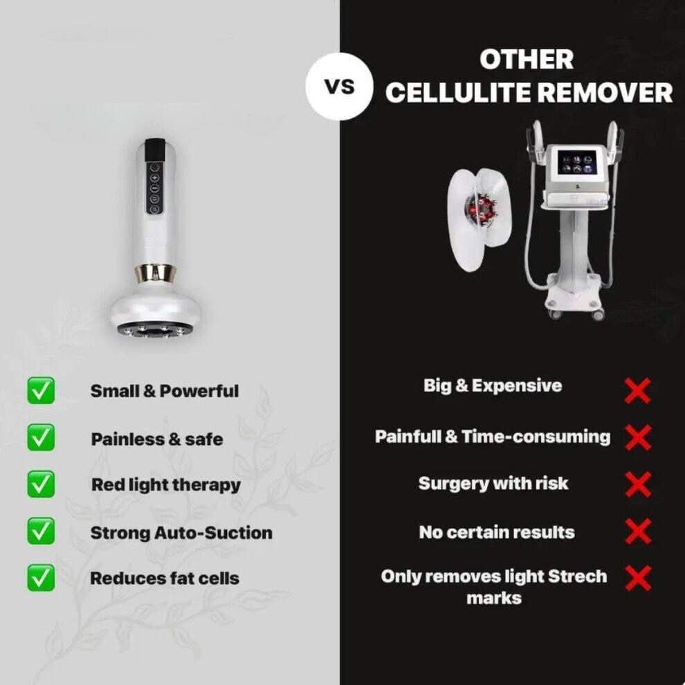 VitaSculpt™ Cellulite Relief Kit device compared to other cellulite removers with benefits listed.